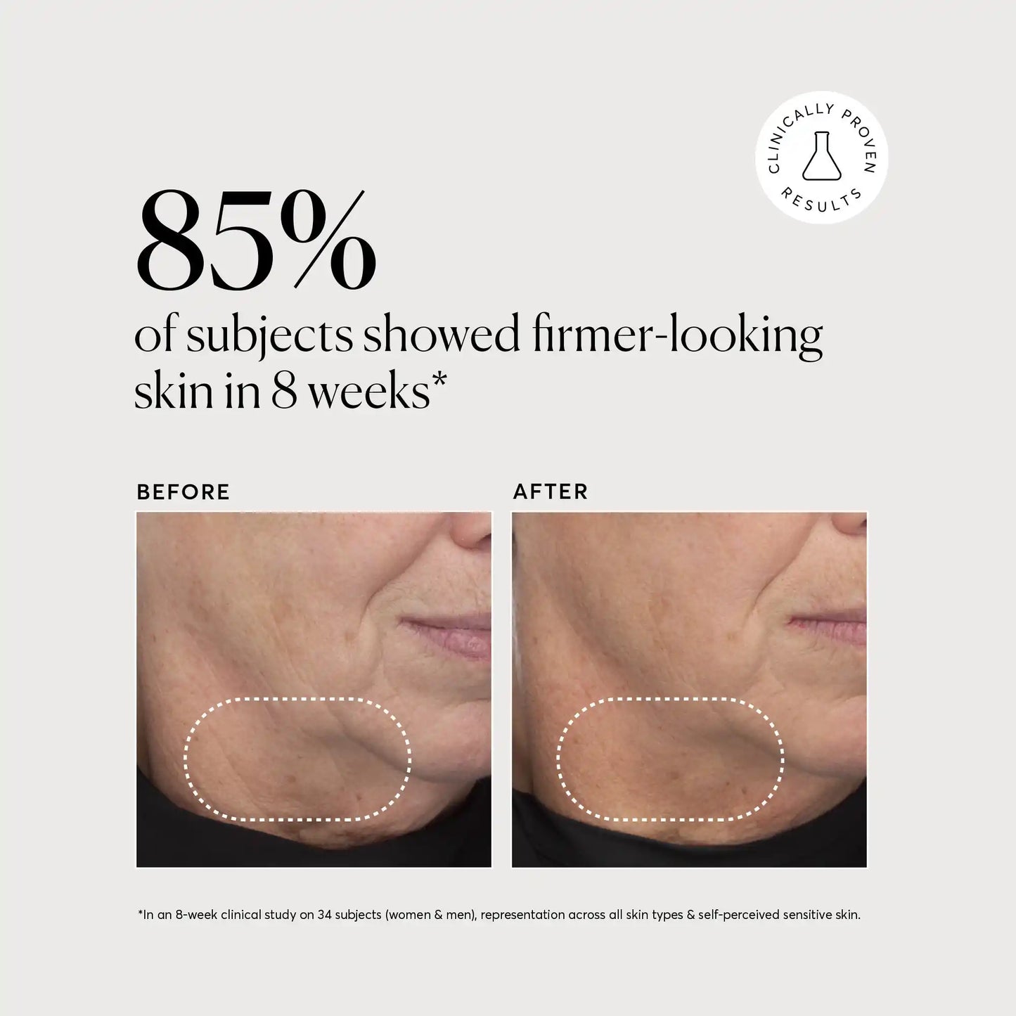 retinol-complex-serum-v7 NATR-10034-Alt-Images-Retinol-Complex-Serum-04.webp